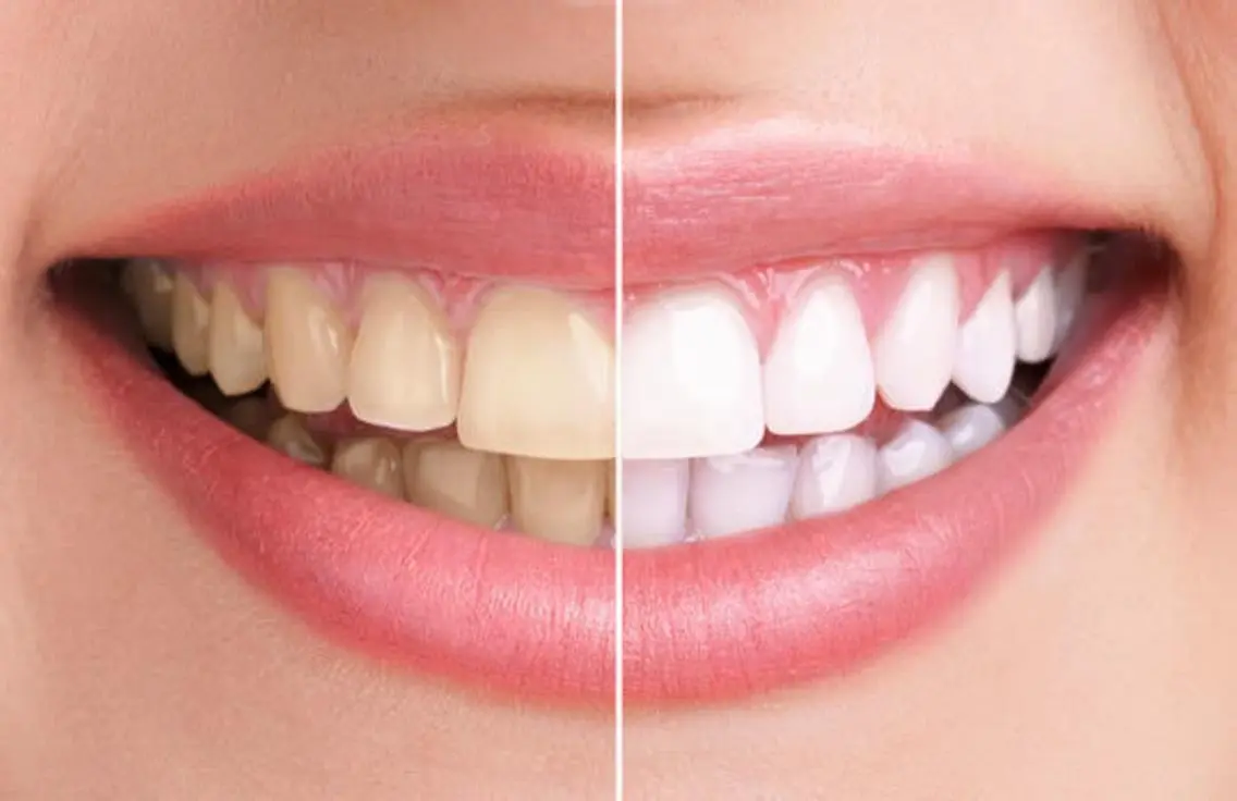 Ｍ渋谷 セルフホワイトニングのその他イメージ