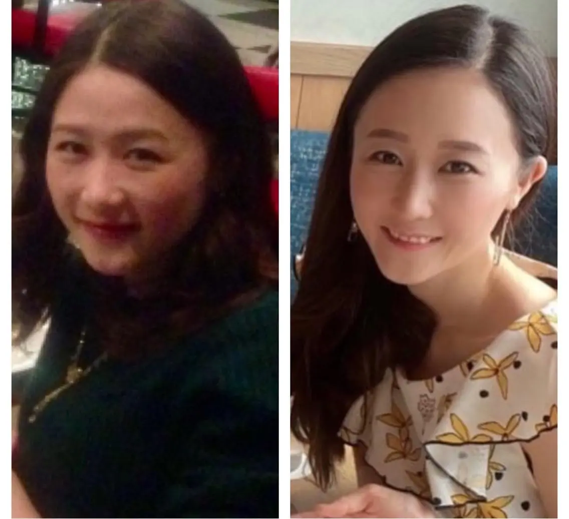 【キュッと小顔&毛穴レス+デコルテマッサージ】欲張り70分💄(小顔矯正+毛穴洗浄+デコルテ流し)✨の写真