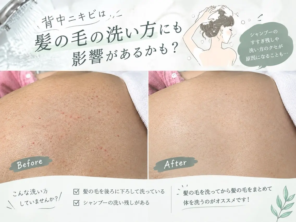 その他 🫧美しい素肌へ🫧 今成柚乃のその他イメージ