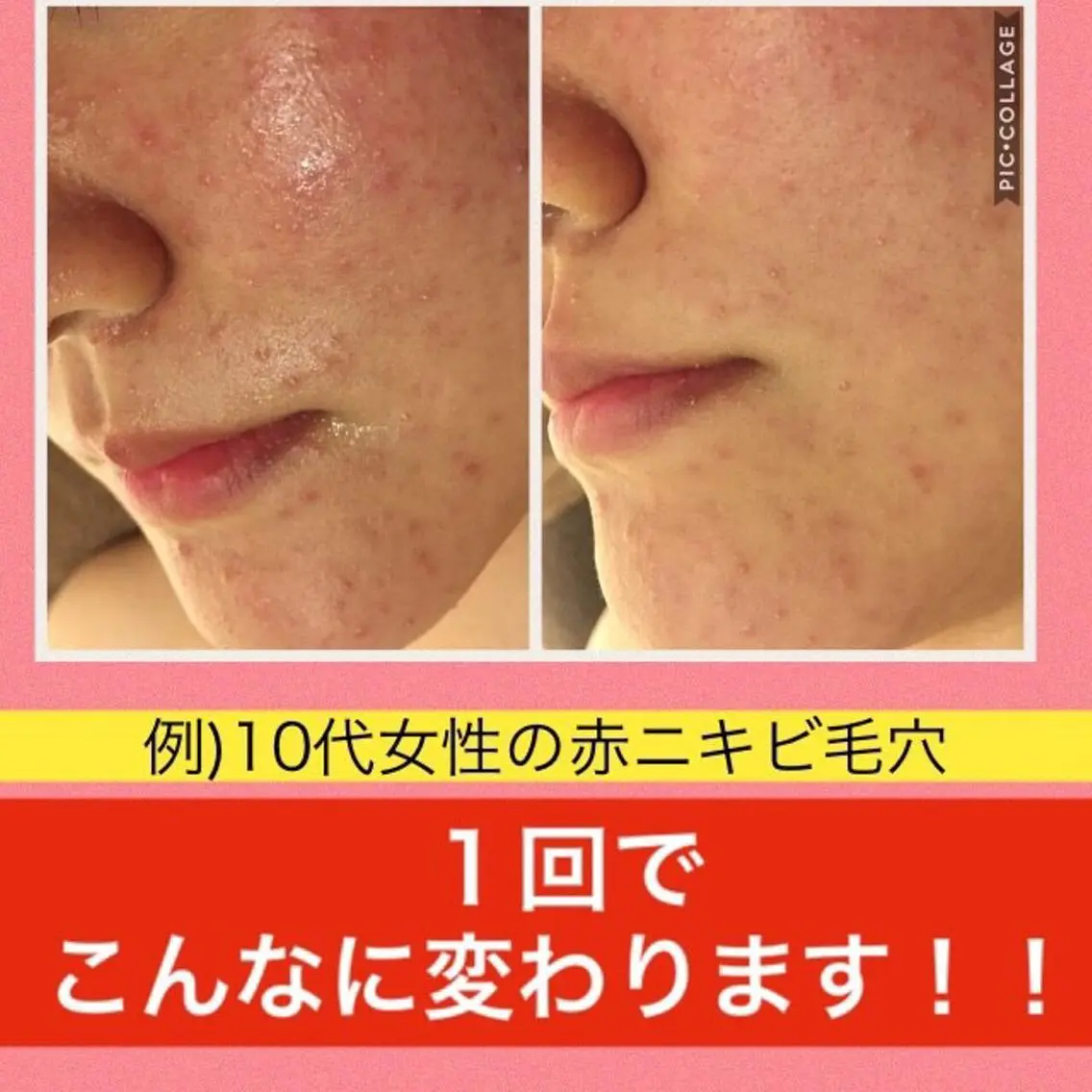 ミディアム カラー パーマ ヘアアレンジ メンズ キッズ ネイル マツエク・マツパ エステ リラク ニキビ・肌質改善専門 ♡人生が変わるサロンのエステ・リラクイメージ
