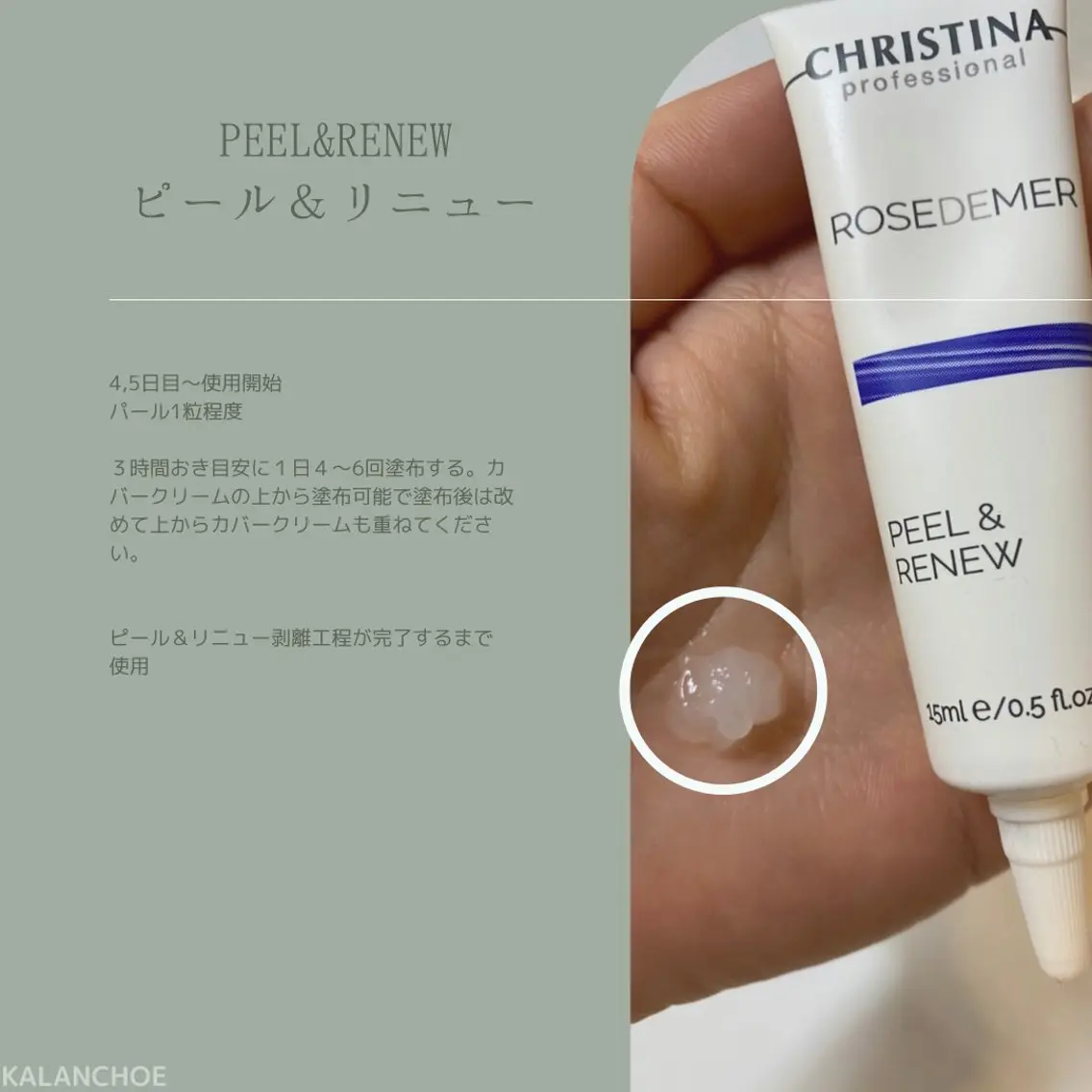 エステ 肌質改善 KALANCHOEのエステ・リラクイメージ