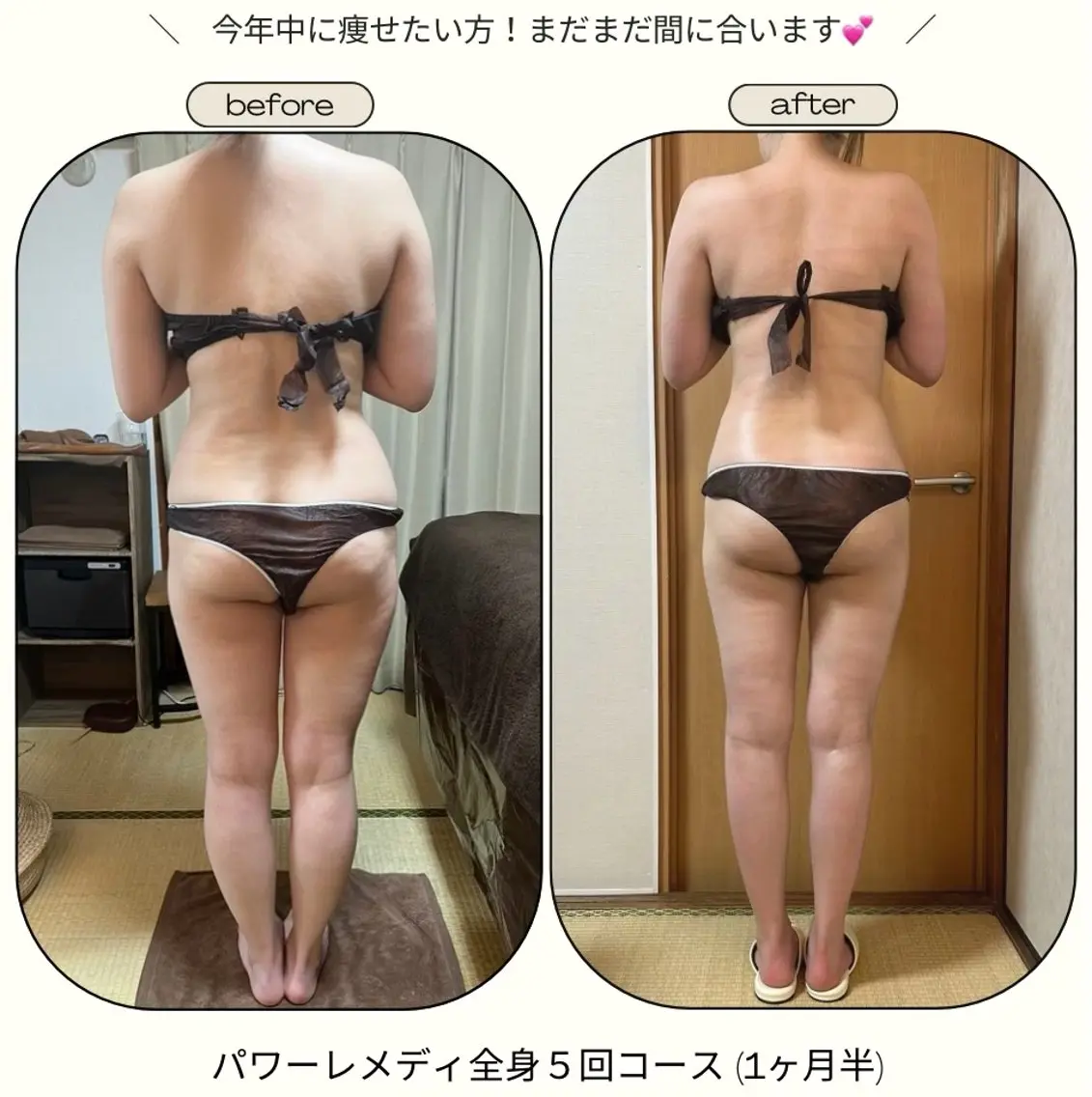 《本気痩せ×疲労改善 》  BILOOPのエステ・リラクイメージ