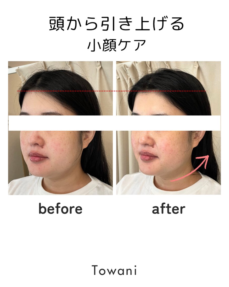 Towani 小顔・ビタミンケアのエステ・リラクイメージ