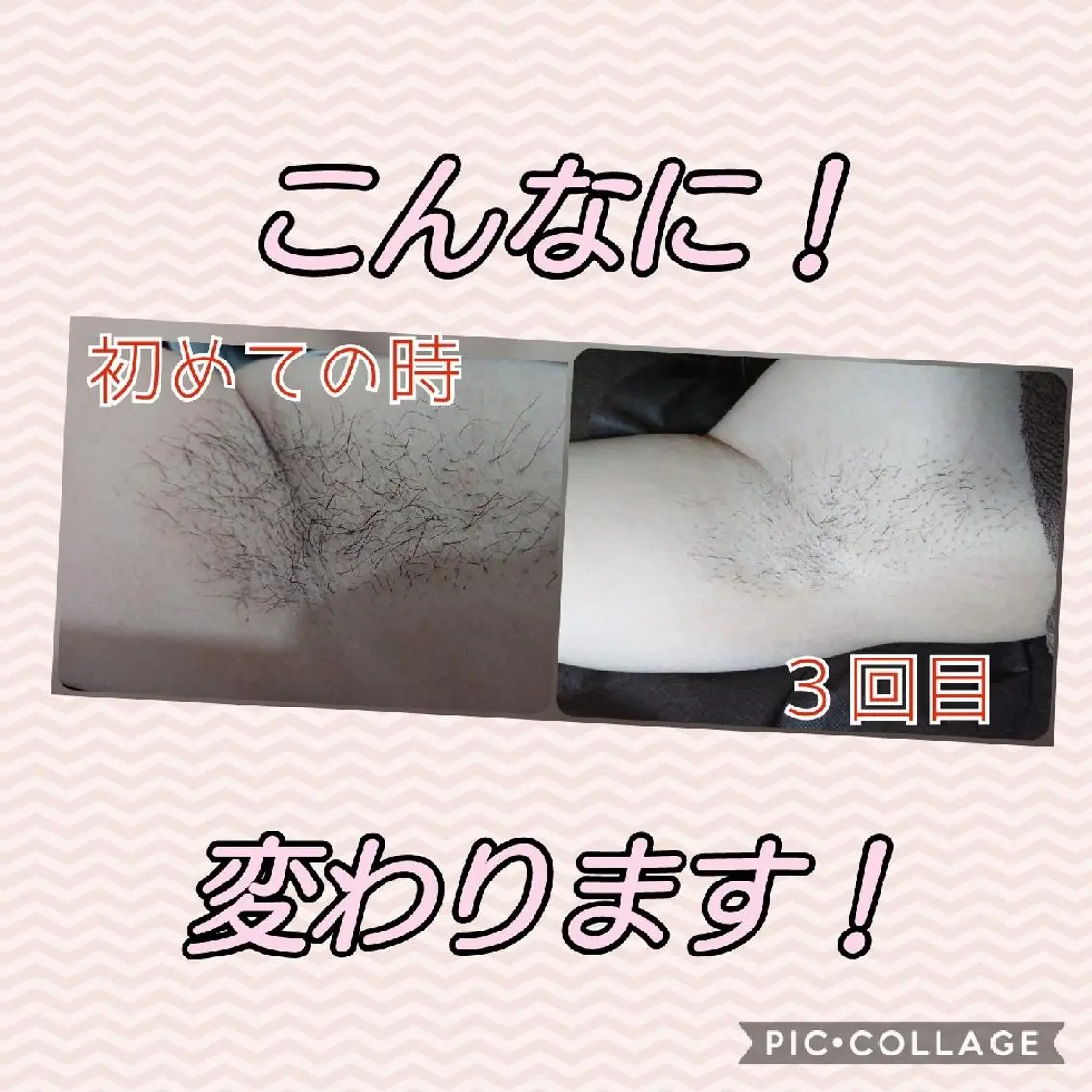 脱毛 リラクゼーション ふわりのエステ・リラクイメージ