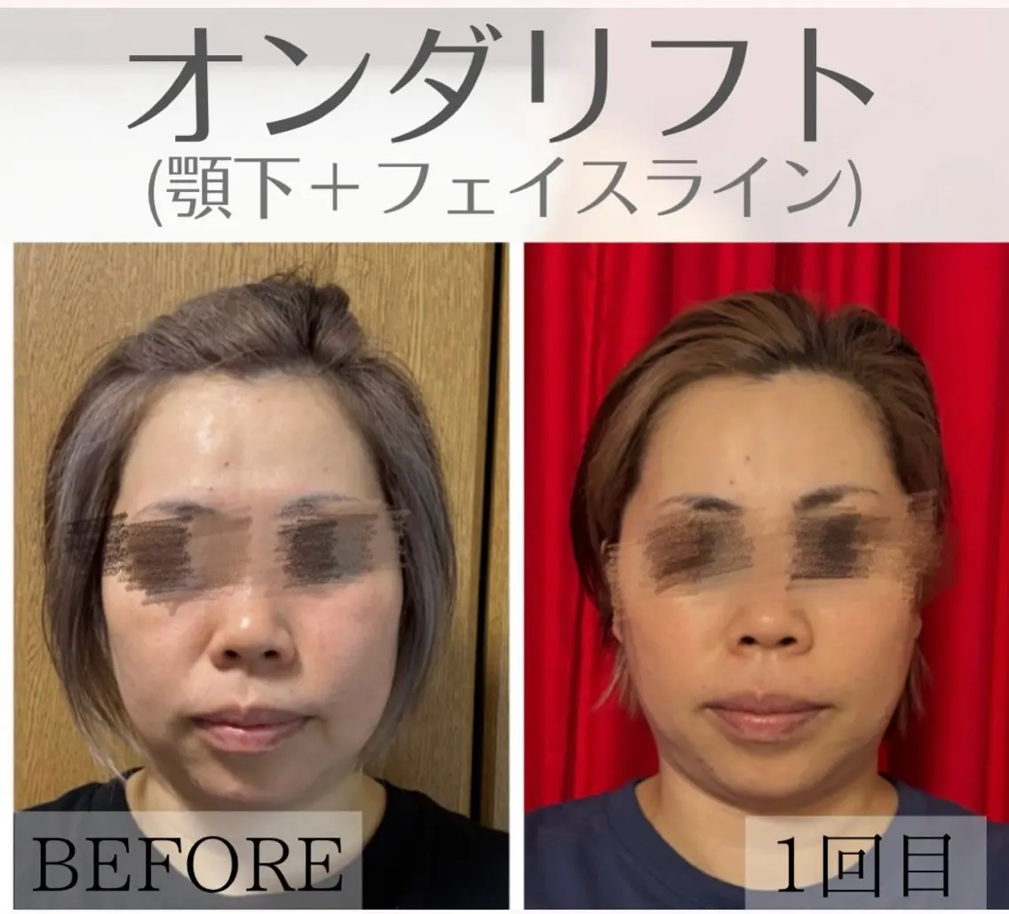 オンダリフト小顔× 痩身・美肌ケアのエステ・リラクイメージ