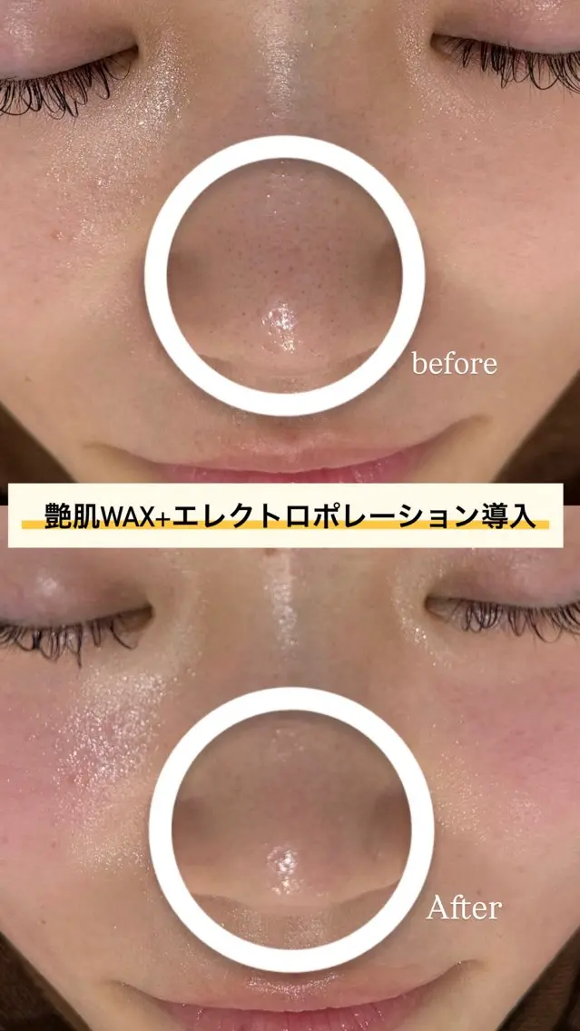 艶肌WAX®＋美容液導入ケア✨｜毛穴汚れ・乾燥・ツヤの写真