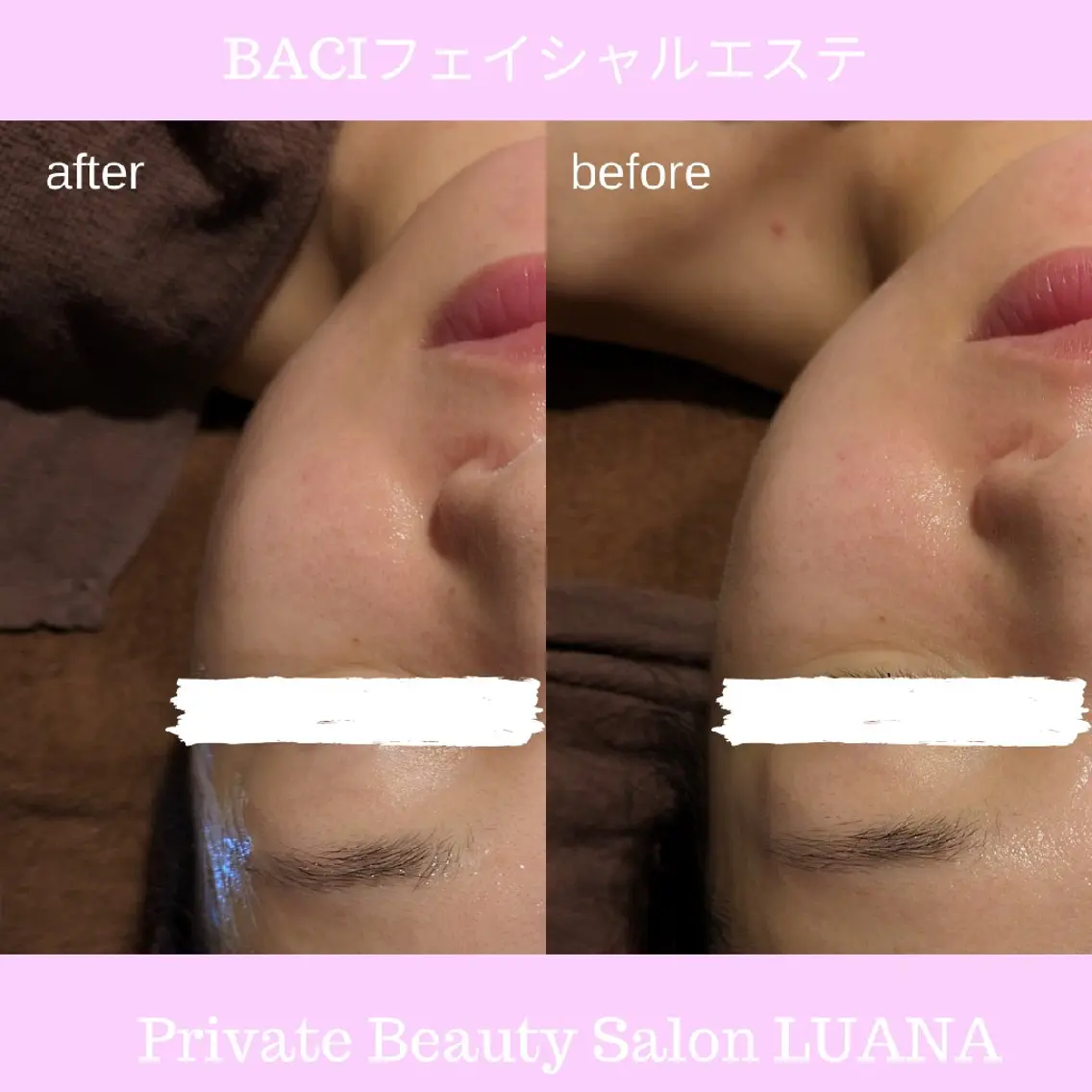 エステ 肌管理専門！BACI 加盟店LUANAのエステ・リラクイメージ