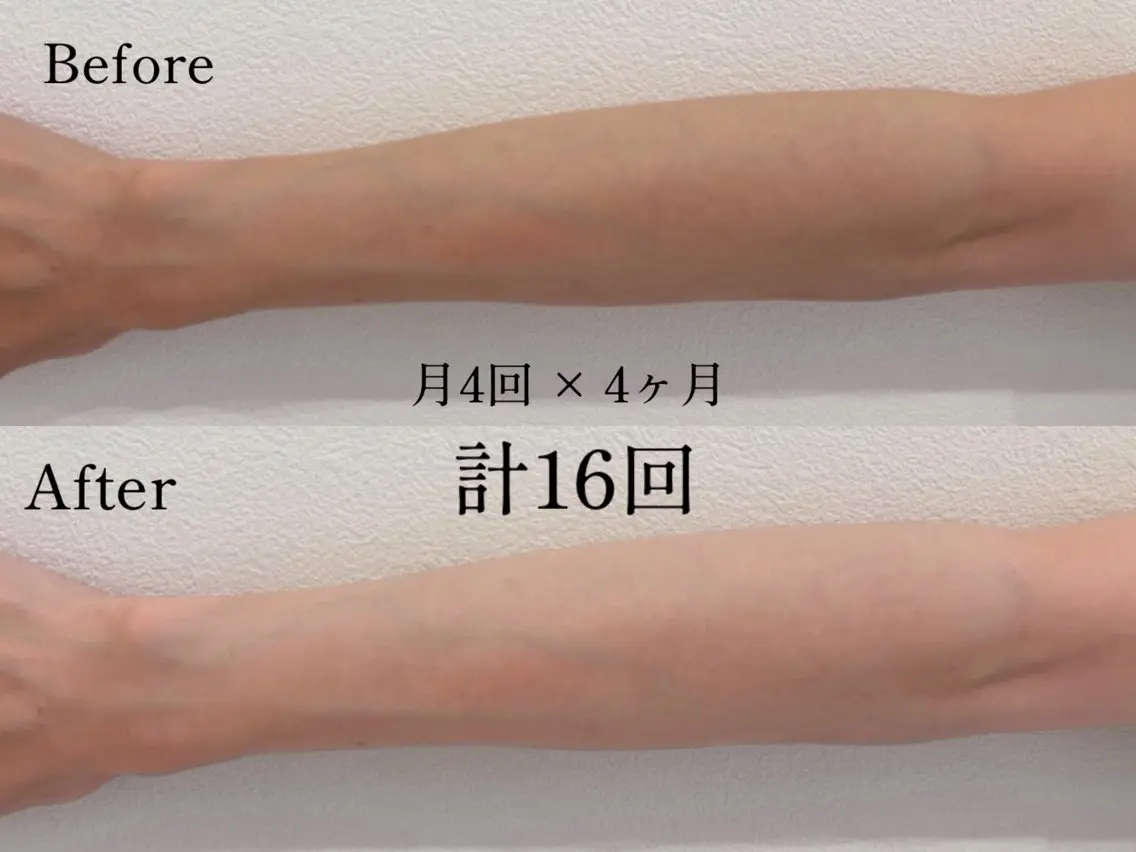 【逆日サロ⁉︎透明感取り戻し作戦】の写真