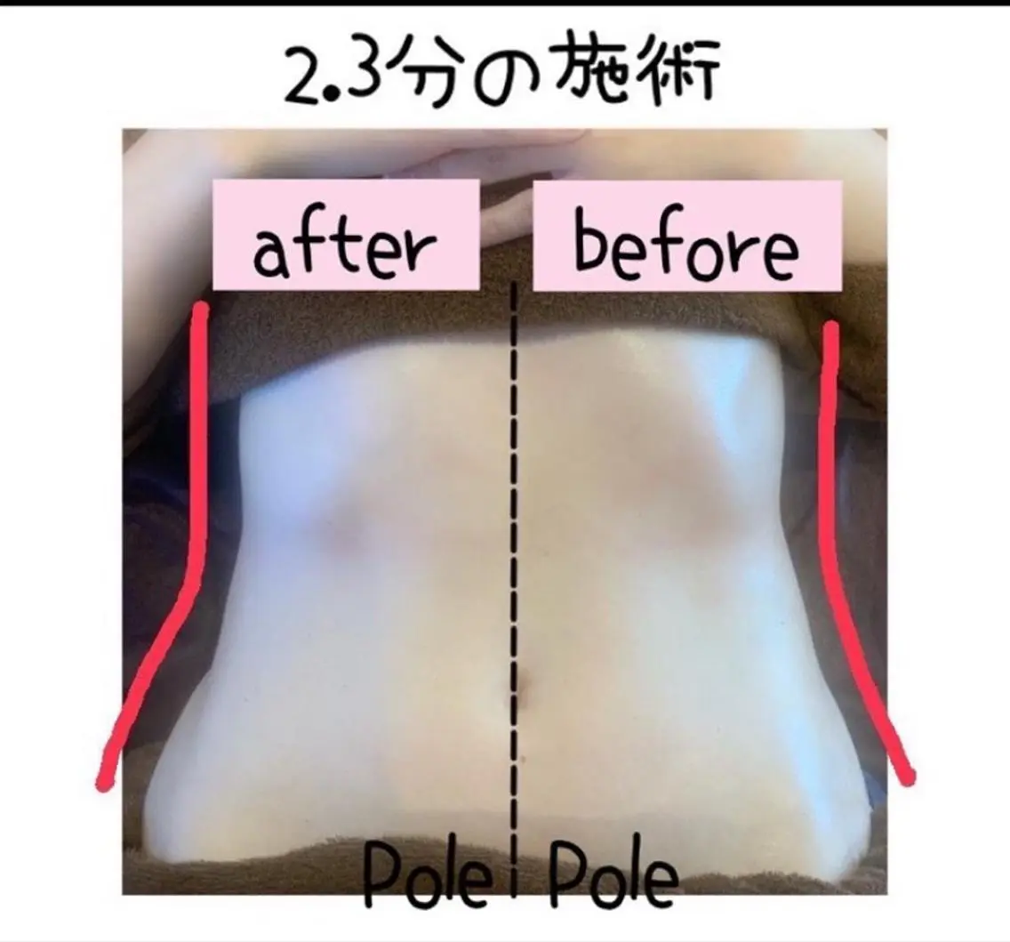 【1番人気】 コリ&痩身コース 90分の写真
