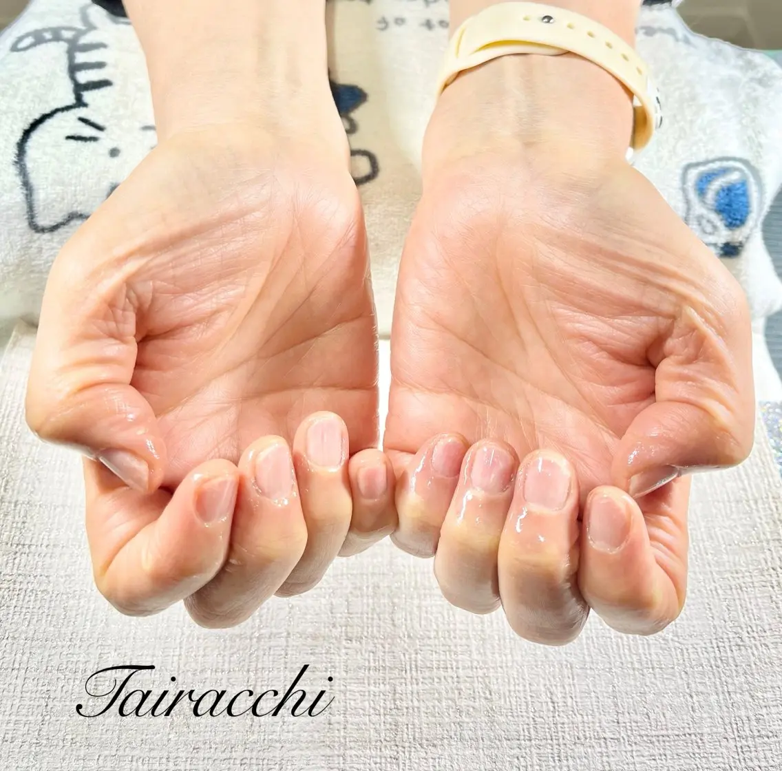 ネイル ラメ(グリッター) ハンドケア Tairacchi ﾀｲﾗｯﾁのエステ・リラクイメージ