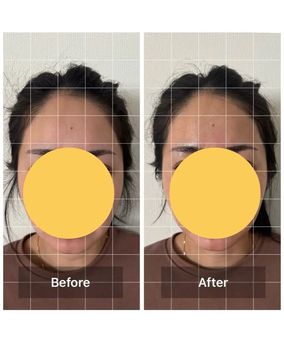 【単品】リフトアップコースの写真