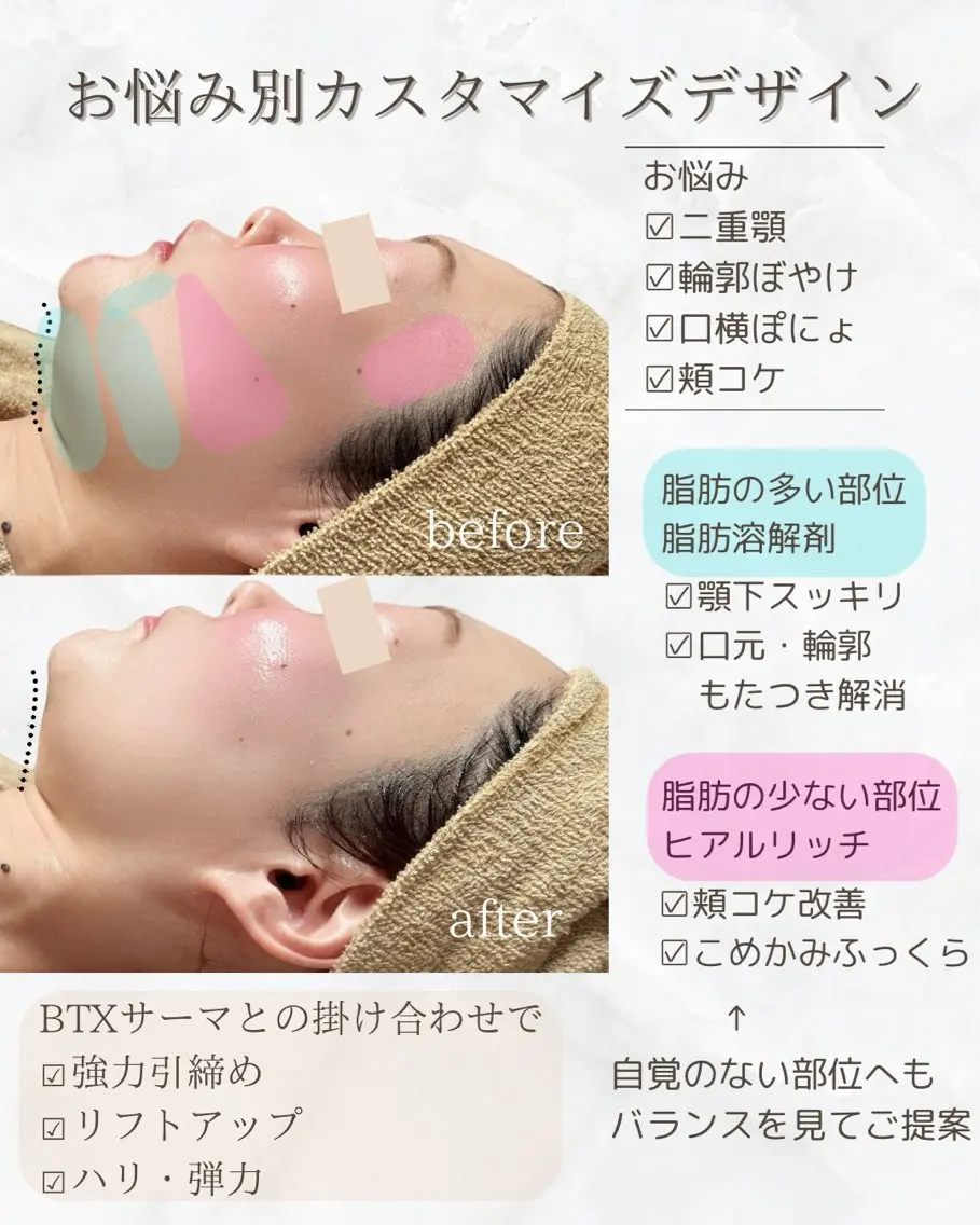 小顔と美肌サロン クリニカルサロンココのエステ・リラクイメージ
