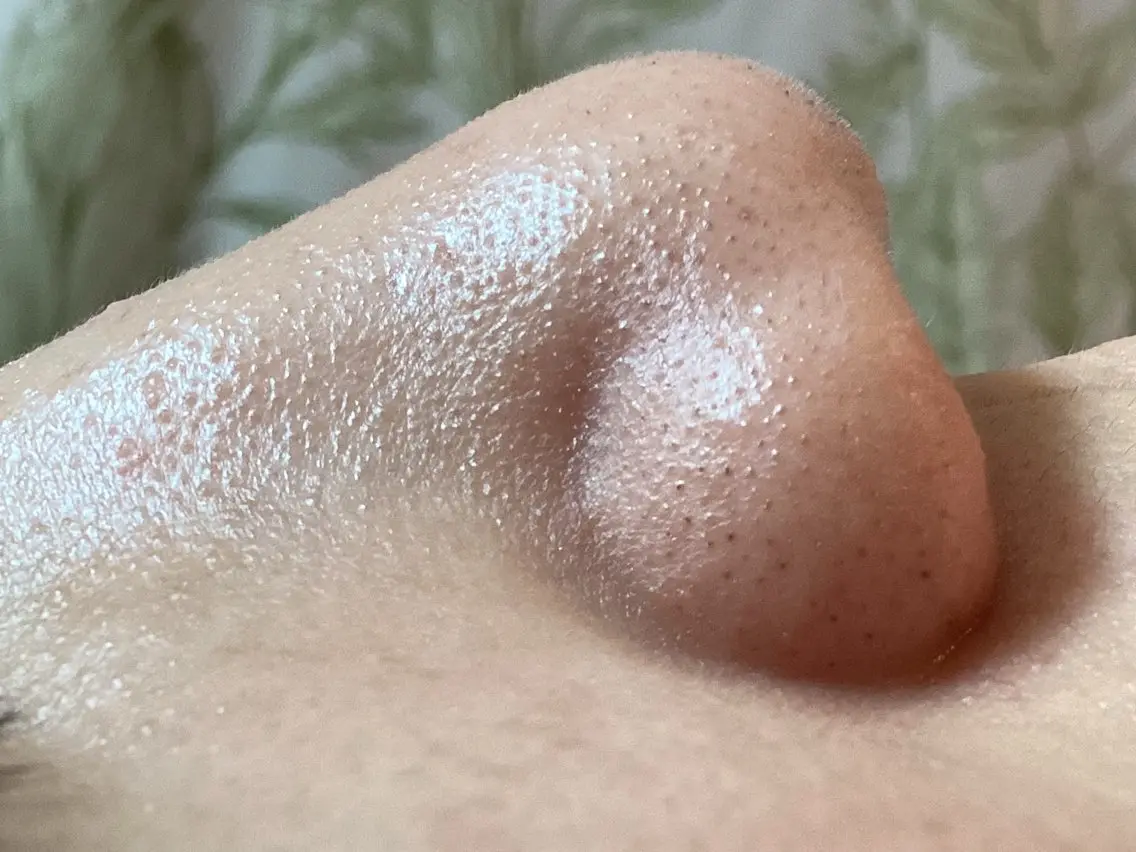 【初回限定】毛穴黒ずみ・ざらつき徹底ハイドロ美容液洗浄💦トライアル(メンズOK)【その場で口コミで200円OFF!】の写真