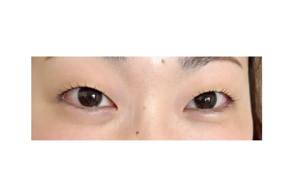 マツエク・マツパ 一重×まつ毛パーマ eyelist yoshinoのマツエク・マツパデザイン