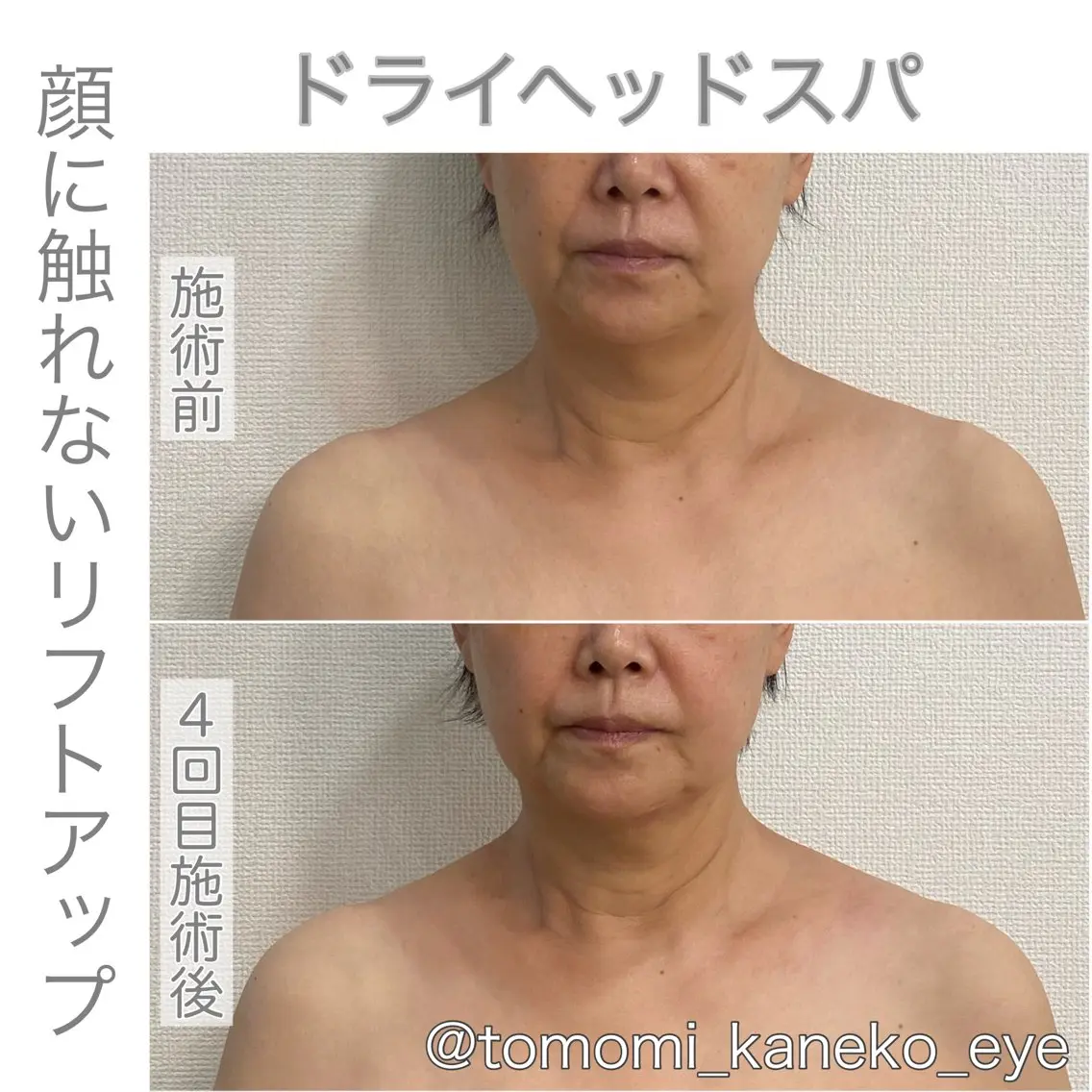 〈メイク落とし不要〉〈顔に触れないリフトアップリラク〉〈新メニュー導入〉モニター募集14000円→5500円 ミニモ限定の写真