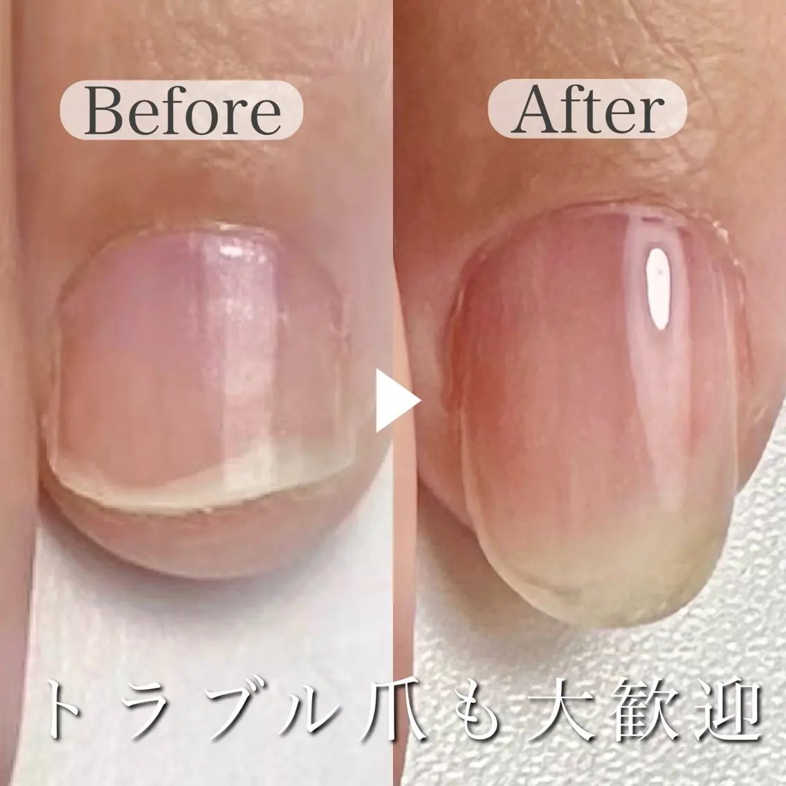 ネイル ピンク 深爪専門店 サロンリリーのネイルデザイン