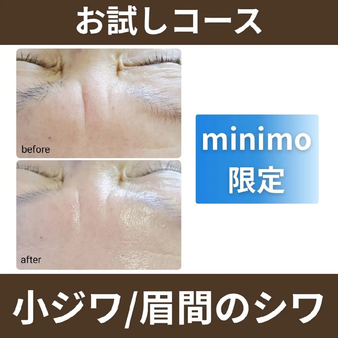エステ 肌悩み解決サロン ハーブピーリングのエステ・リラクイメージ