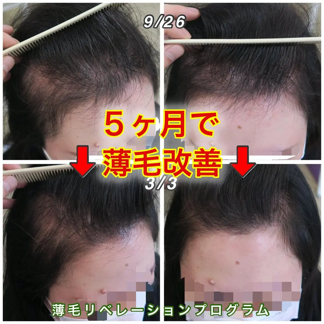 ミディアム カラー ヘッドスパ 薄毛ケア/痒みケア オガワシンペイのヘアスタイル