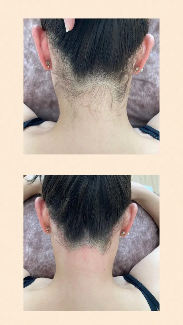 うなじ ※補足説明を必ずご確認くださいの写真