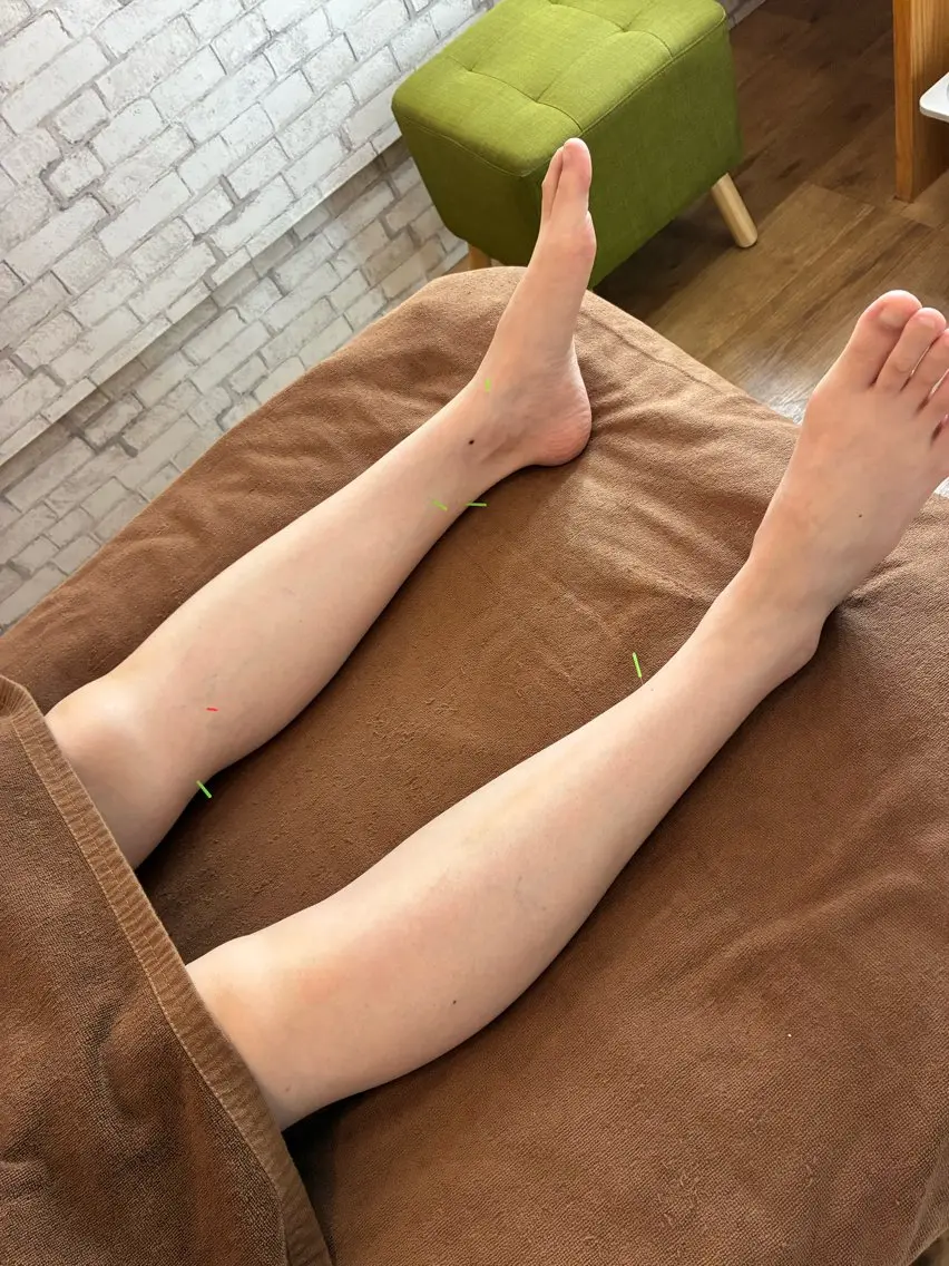 女性専用鍼灸サロン harimyﾊﾘﾐｰのエステ・リラクイメージ