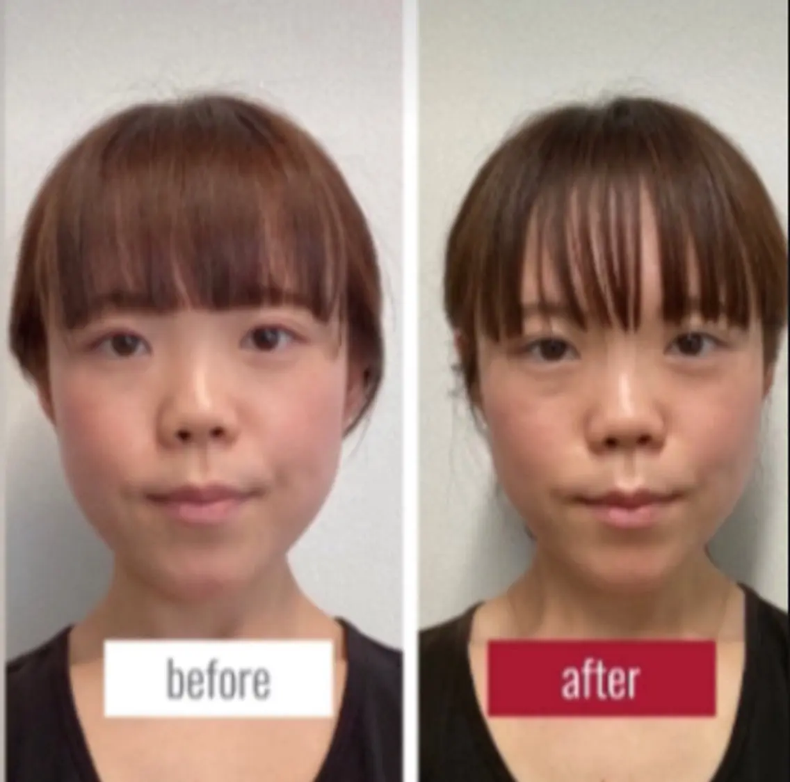 【京都人気No.1】小顔矯正+身体＋姿勢矯正フルセット90分【通常¥24,890】の写真