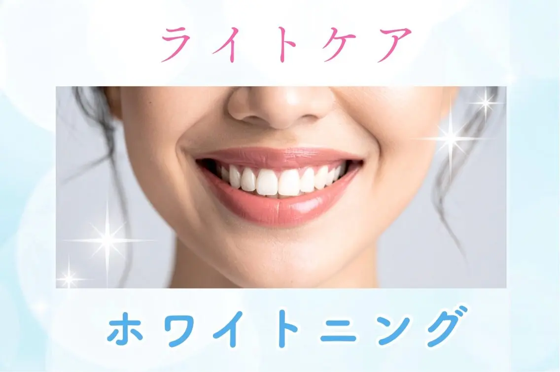 【とりあえず体験したい方へ】ライトプラン🦷✨歯本来の白さを手に入れる🫶メンテナンスにもおすすめの写真