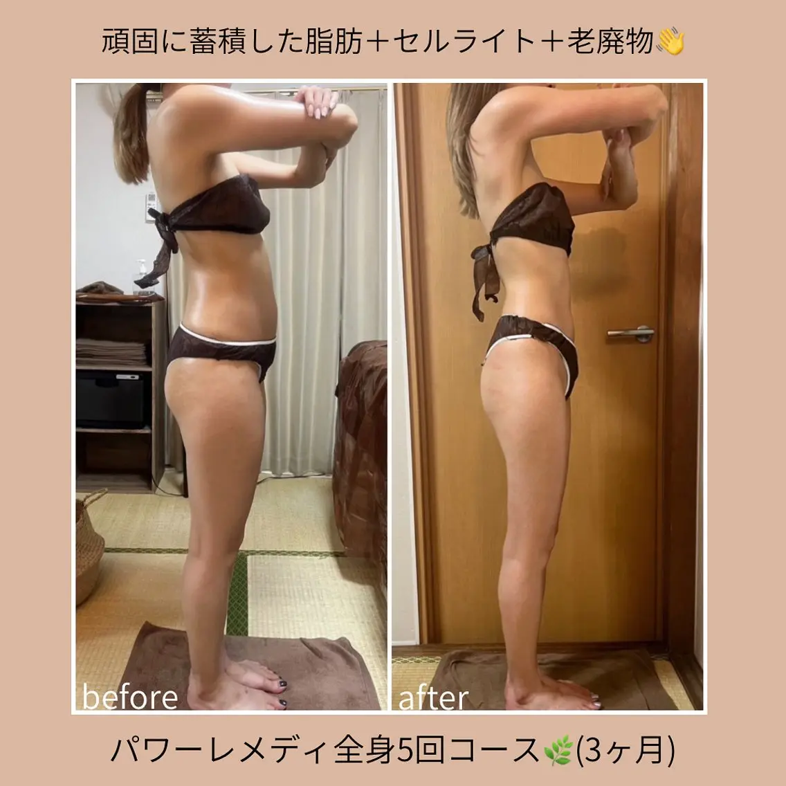 《本気痩せ×疲労改善 》  BILOOPのエステ・リラクイメージ