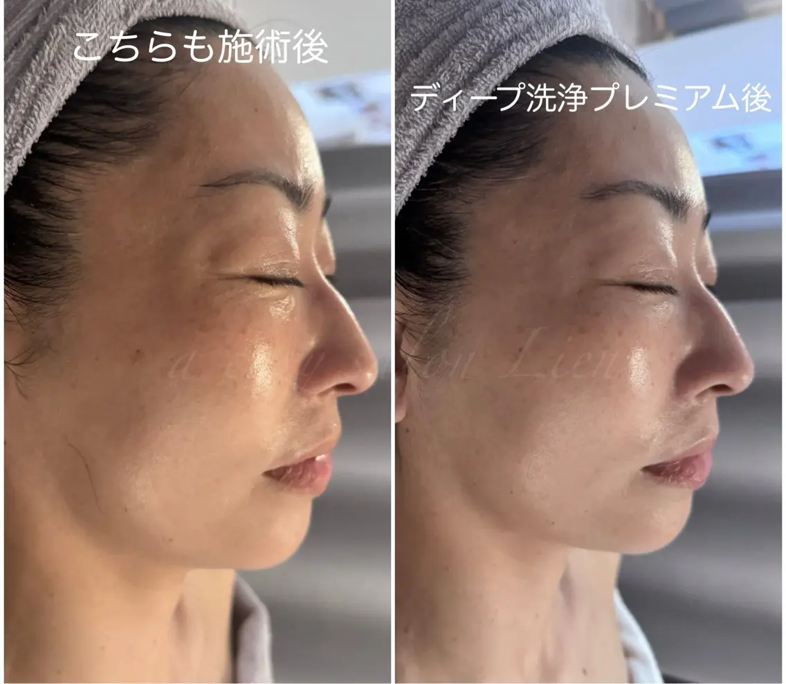 エステ 渡邊 しずかのエステ・リラクイメージ