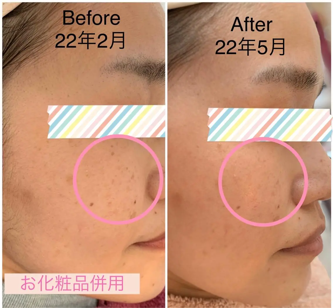 シミケア E Lashのエステ・リラクイメージ