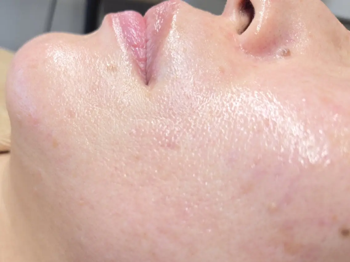 フェイシャルwax   (部分、2ヶ所選択)の写真