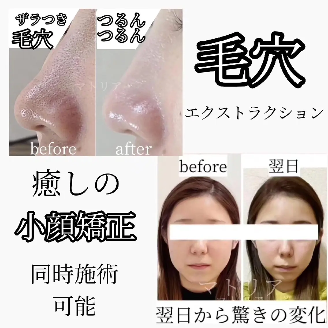 小顔 美肌専門 Matoriaのエステ・リラクイメージ