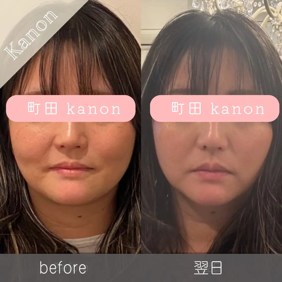 小顔矯正サロン町田 逸見智美のエステ・リラクイメージ