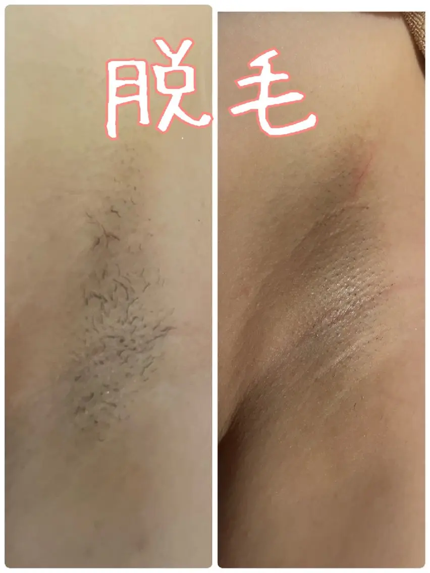 脱毛 エステsala藤沢 sanaeのエステ・リラクイメージ