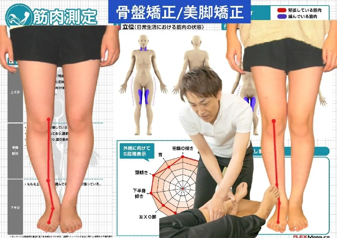 【美脚矯正】IT姿勢診断無料/O脚X脚・太さ/80分の写真