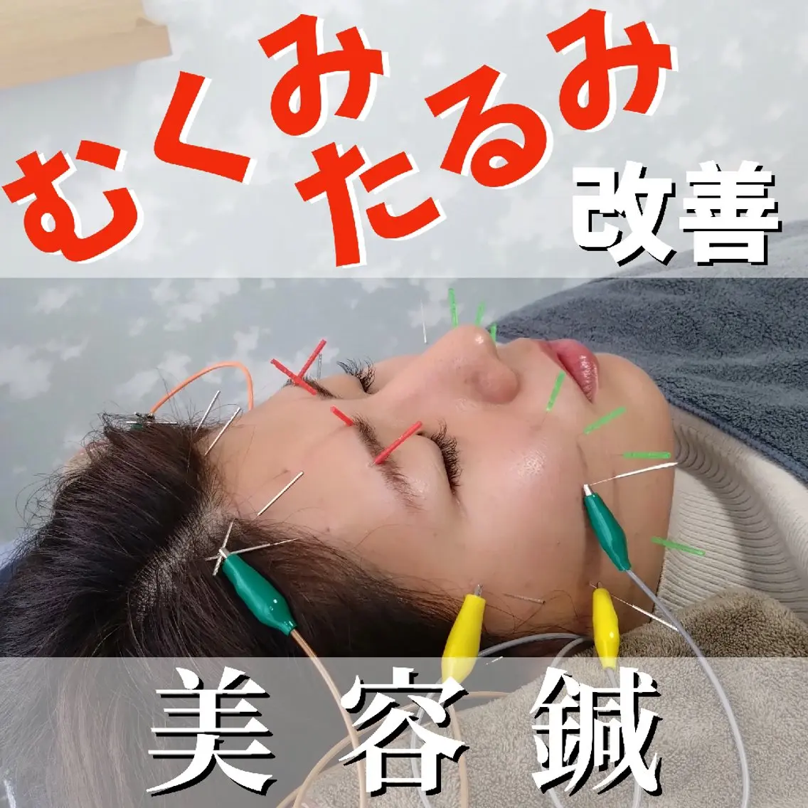 エステ リラク 小顔と姿勢改善のプロ ｜整体と美容鍼のぐちのエステ・リラクイメージ