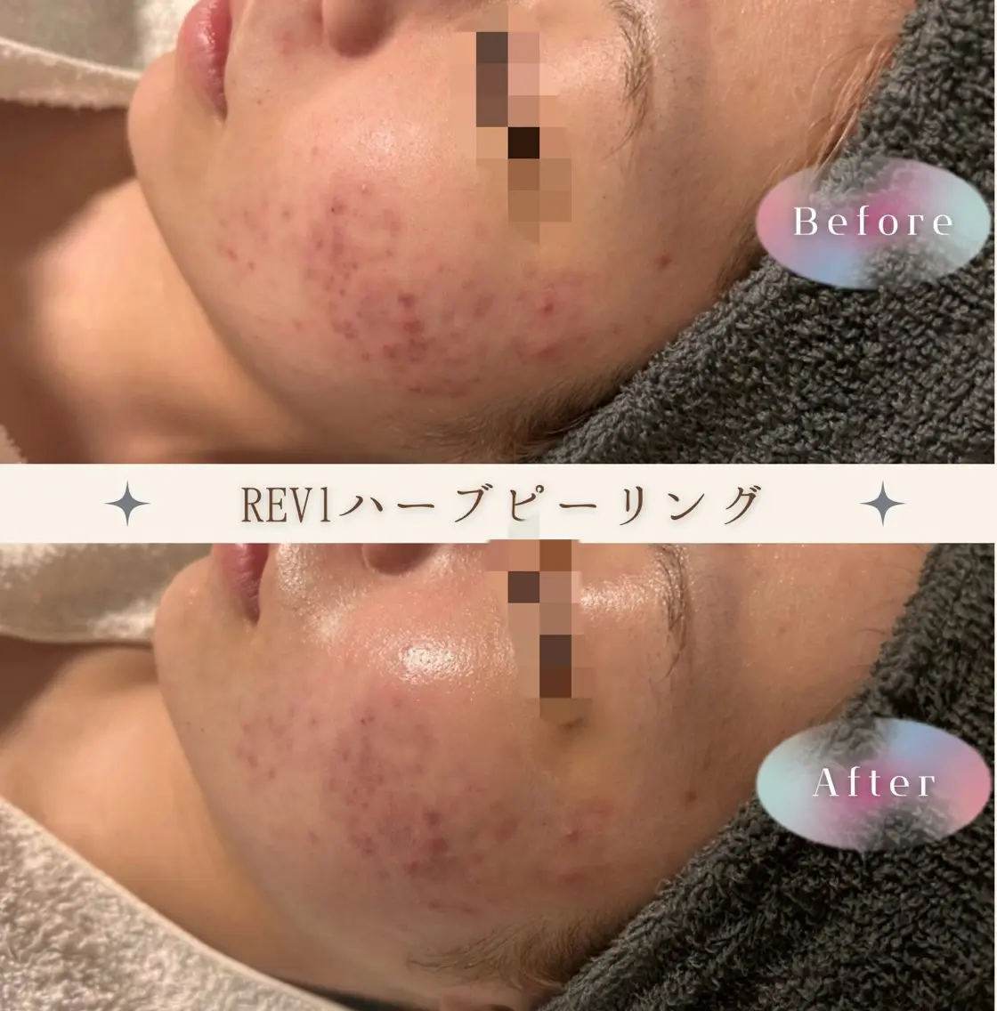 lumi riseのエステ・リラクイメージ