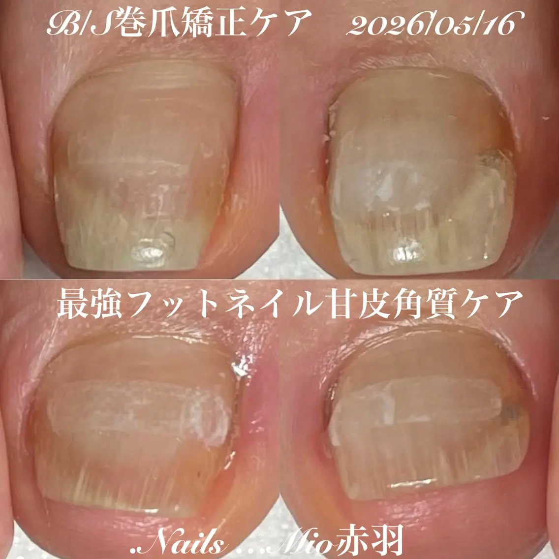 ネイル フットネイル .Nails Mio 赤羽西ネイルサロンのネイルデザイン