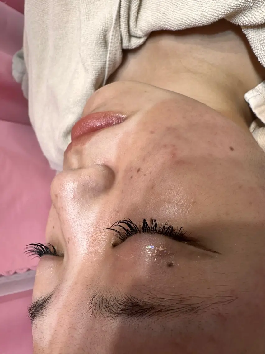 通常メニュー　お顔剃り＋拭き取りパックの写真