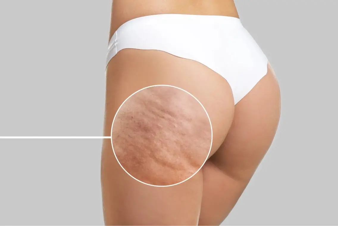 美骨格調整サロン Nemophilaのその他イメージ