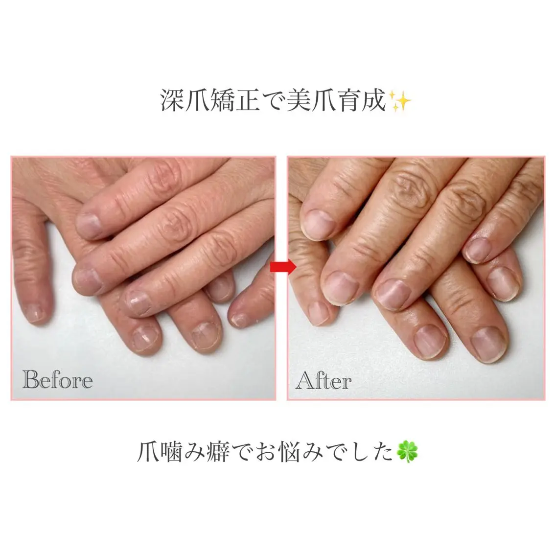 ネイル ネイルサロン アリュームのネイルデザイン
