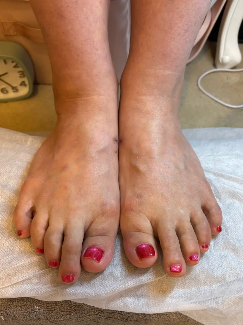 ネイル マグネットネイル 赤色 フットネイル ハンドケア Amys nail シヅキのネイルデザイン
