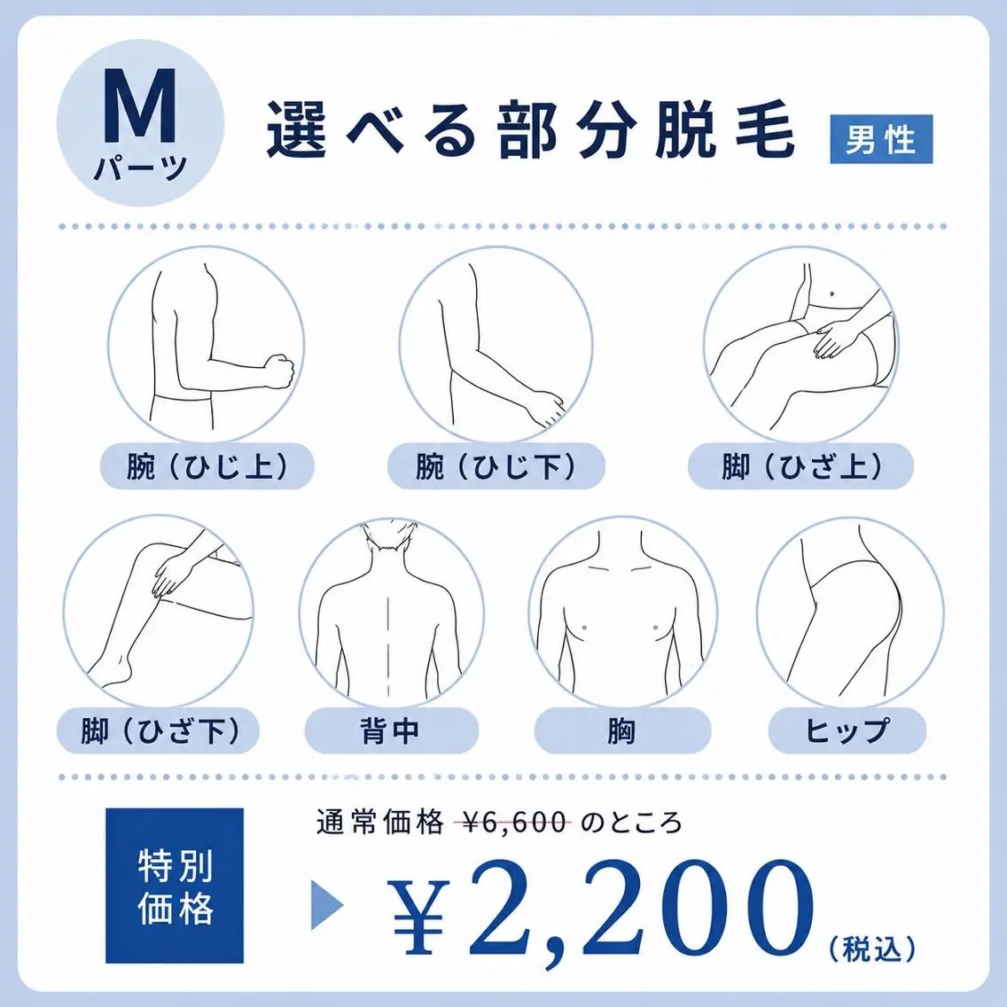 【7月限定】選べるMパーツ脱毛(男性)¥6,600→¥2,200の写真