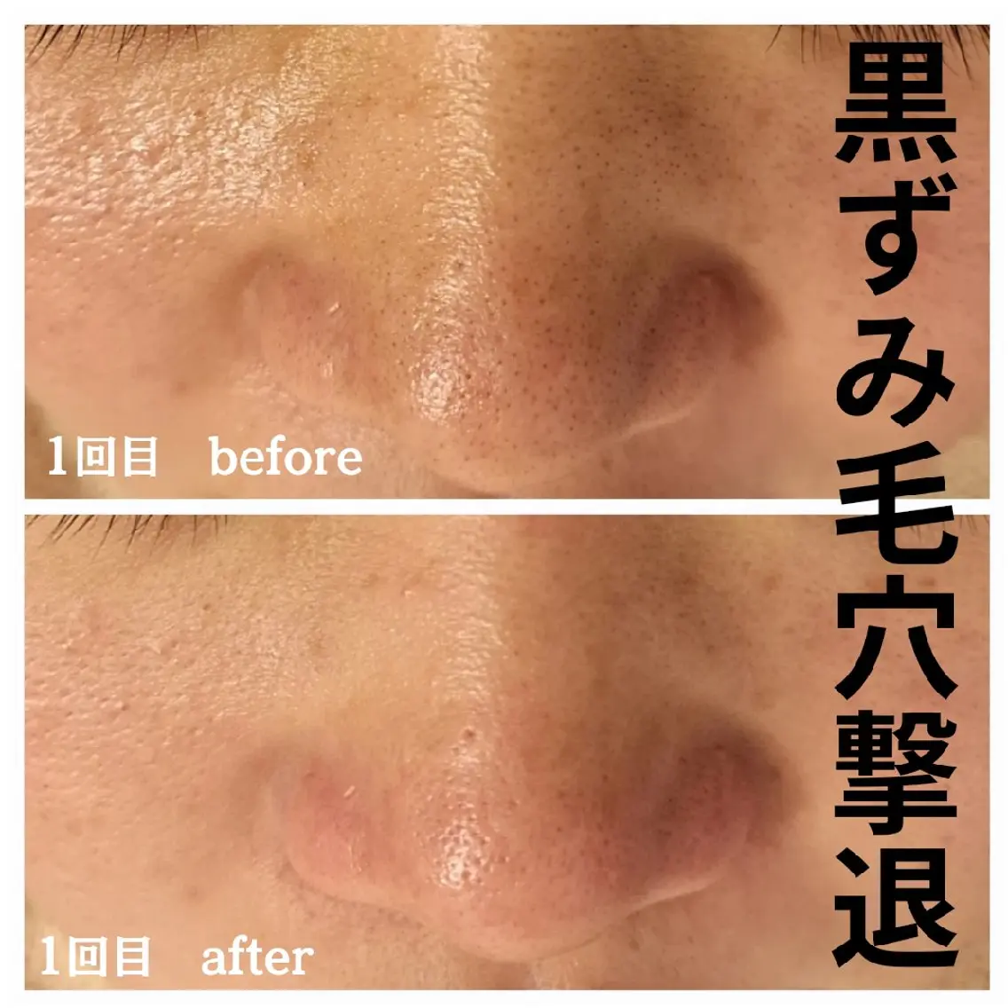 フェイシャル専門サロ ン ERINのエステ・リラクイメージ
