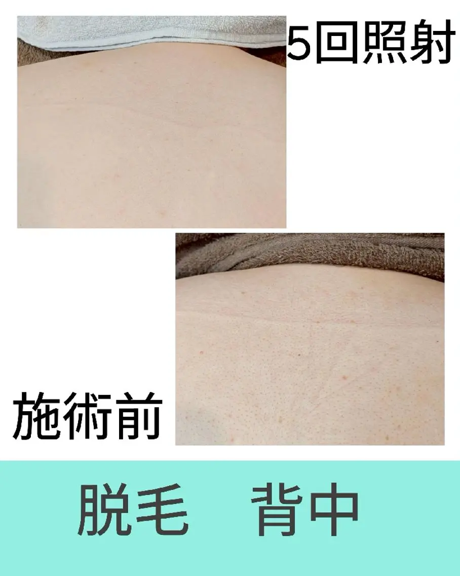 脱毛 坂下 咲子のエステ・リラクイメージ