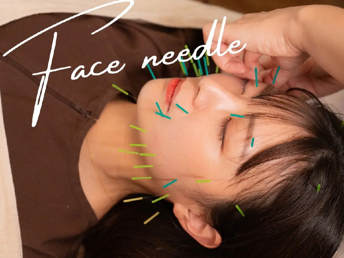 【首が長くなる美容鍼🪡】美容鍼で即小顔に！モデル・芸能人のような小顔💆‍♀＋首肩デコルテマッサージ付✨の写真