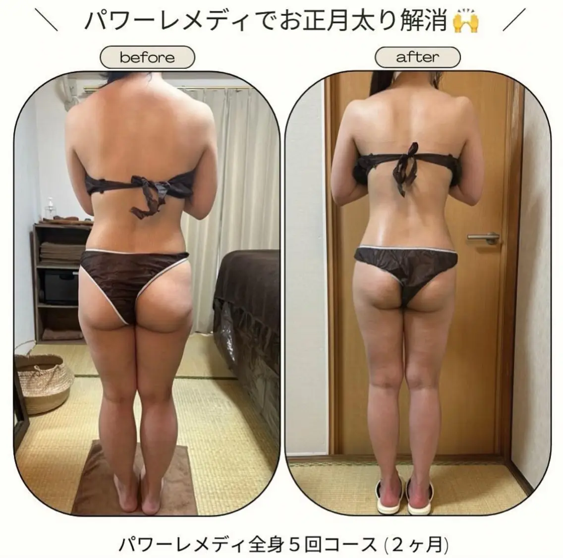 エステ リラク 《本気痩せ×疲労改善 》  BILOOPのエステ・リラクイメージ