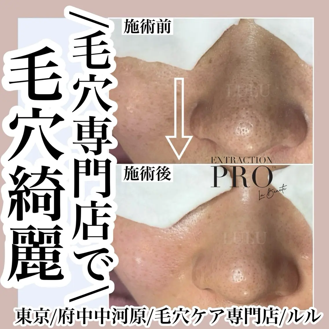 エステ LULU ルルのエステ・リラクイメージ