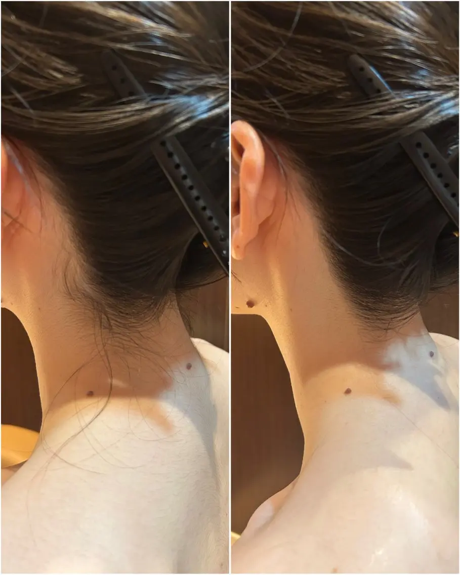 レディースシェービング👧🏻✨個室へご案内の写真