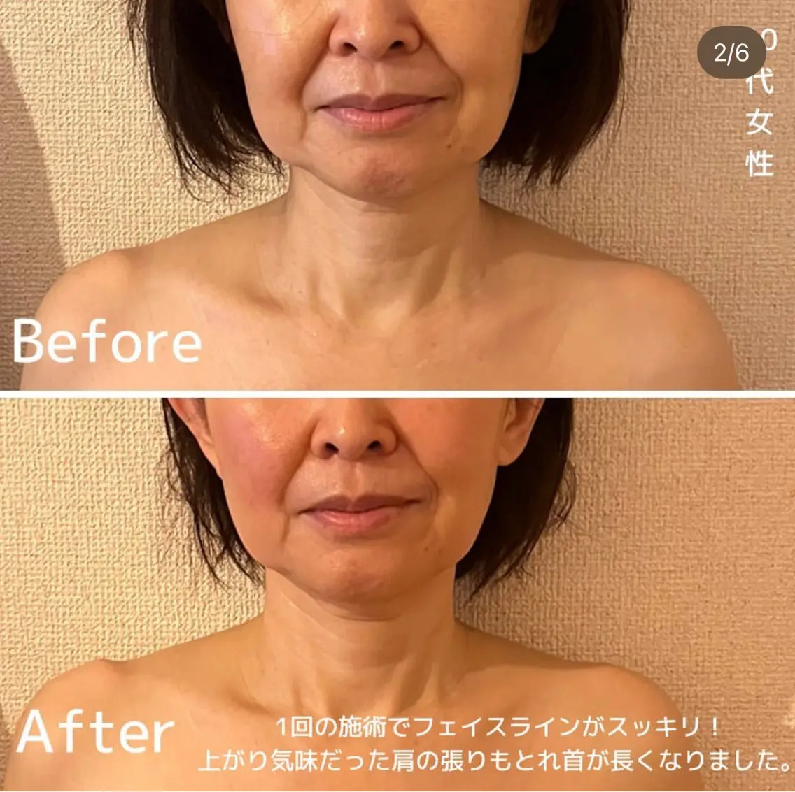 エステ リラク 表情筋フェイシャル 三軒茶屋のエステ・リラクイメージ