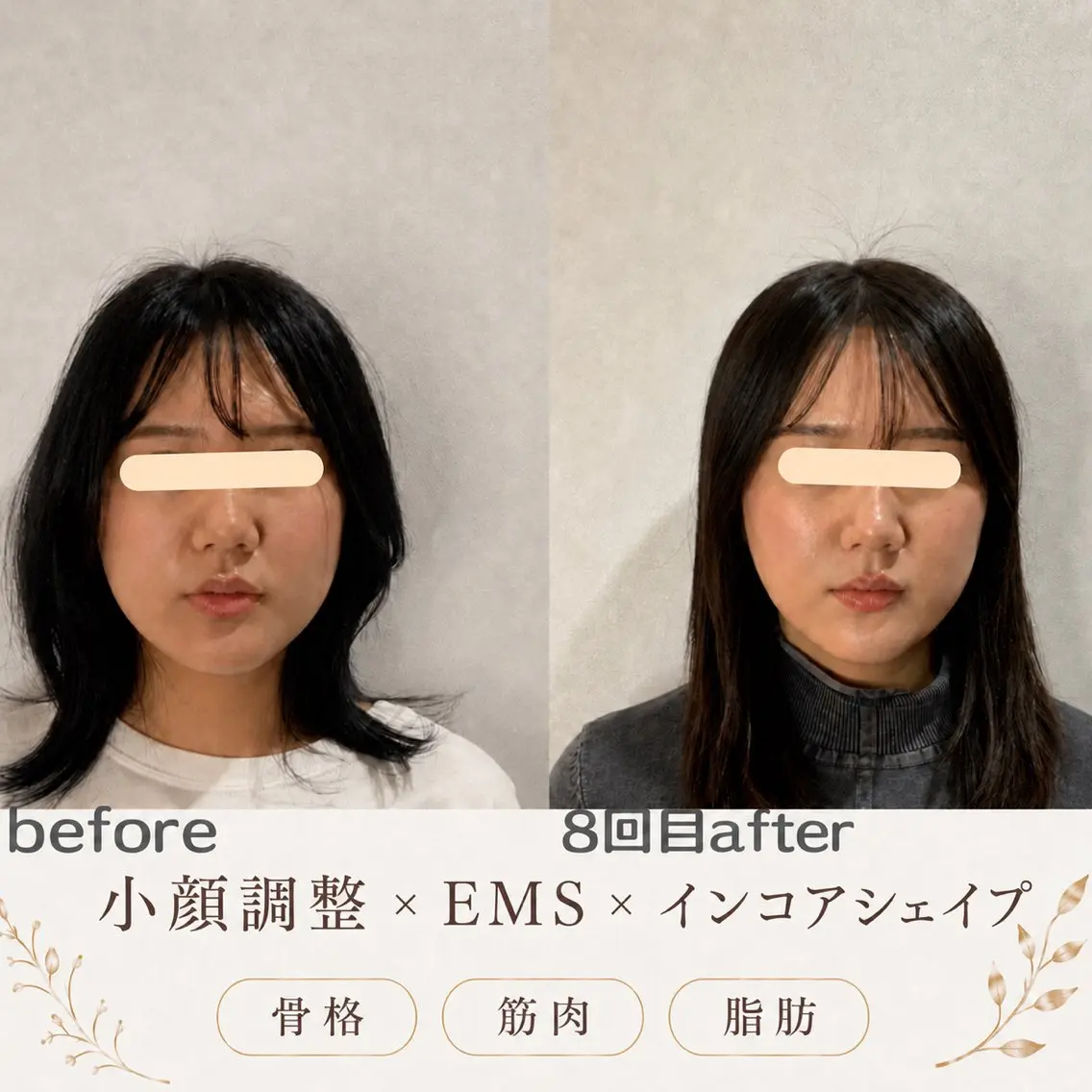 エステ リラク 最速小顔・肌質管理 espoirマキのエステ・リラクイメージ